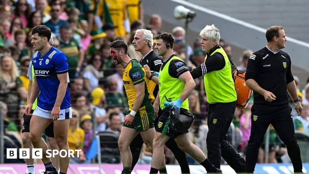 The GAA Social: McConville feels GAA will ‘go after McGuinness’ Jim McGuinness with a bloodied Ryan McHugh