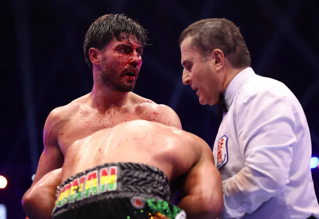 Josh Kelly looks to Jaron Ennis and big names after bloody win over Caoimhin Agyarko 'HE SHOWED WEAKNESSES' Brandon Figueroa Talks Bruce Carrington and Naoya Inoue Mega Fights